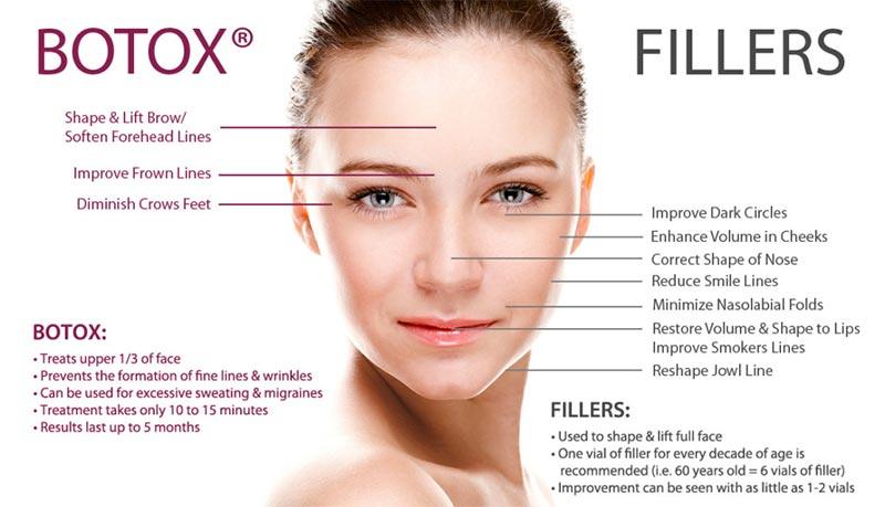 Botox Fillers