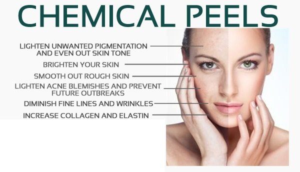 Chemical Peel