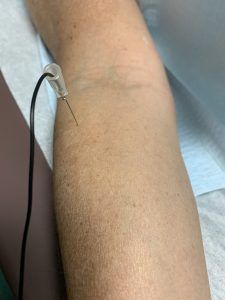 EMG – Electromyography