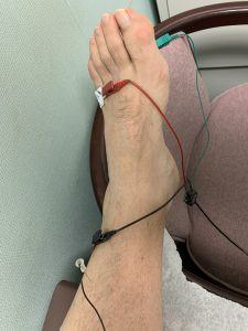 EMG – Electromyography 1