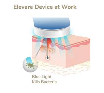 Ivory Light Therapy Image 2