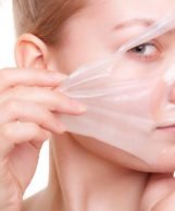 What is a chemical peel?